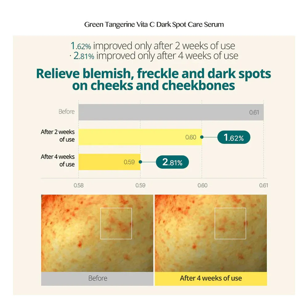 Green Tangerine Vita C Dark Spot Care Serum Set [40ml   20ml SPECIAL EDITION]